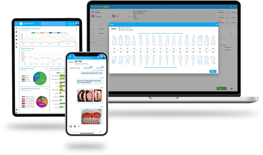 DentalSO – Phần mềm quản lý Dental Lab - Phần mềm quản lý labo nha khoa giá rẻ, cho dùng thử miễn phí
